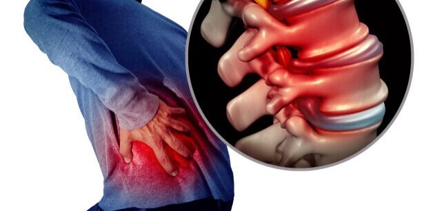 Person with lower back pain holding their back, spinal disc model in inset.